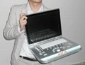 15 Inch LED screen Laptop Color Doppler offer with convex probe 4