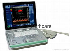 Portable Smart Laptop Color Doppler offer with convex probe built-in battery