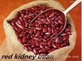 Made in China Red Kidney Bean