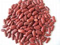 Red Kidney Beans 1