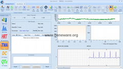 Beneware CardioTrak Holter Analysis Software World First AF Automatic Analysis