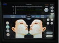 High Intensity Focused Ultrasound HIFU Face lifting Wrinkle removal CE 3