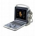 The Portable Ultrasound Scanner Made in China 
