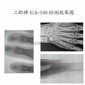 便携式X光安检机ELS-100