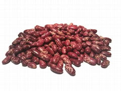 Kidney Beans