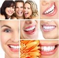 Peroxide Free teeth whitening strips  4