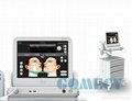 HIFU Face Care Machine High Intensity Focused Ultrasound Slimming  Equipment 1