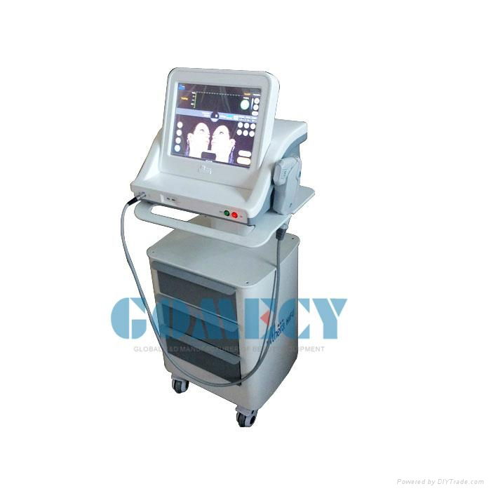 HIFU Face Care Machine High Intensity Focused Ultrasound Slimming  Equipment 2