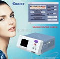 Safety 980nm Spider Vein Blood Vessels Treatment Vascular Removal 2