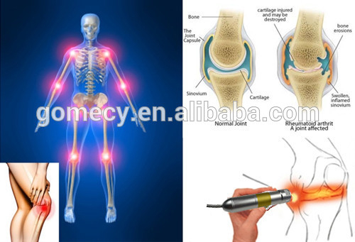 980 nm laser vascular pain relief device physical therapy equipment 2