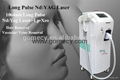 long pulse nd yag laser hair removal hair loss /ND yag laser 1064 treatment  2