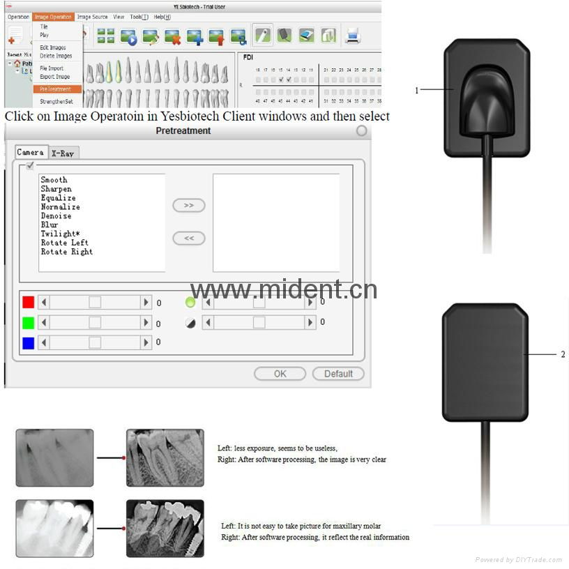 Dental Intraoral X-ray Image System Korea Original Digital Sensor  4