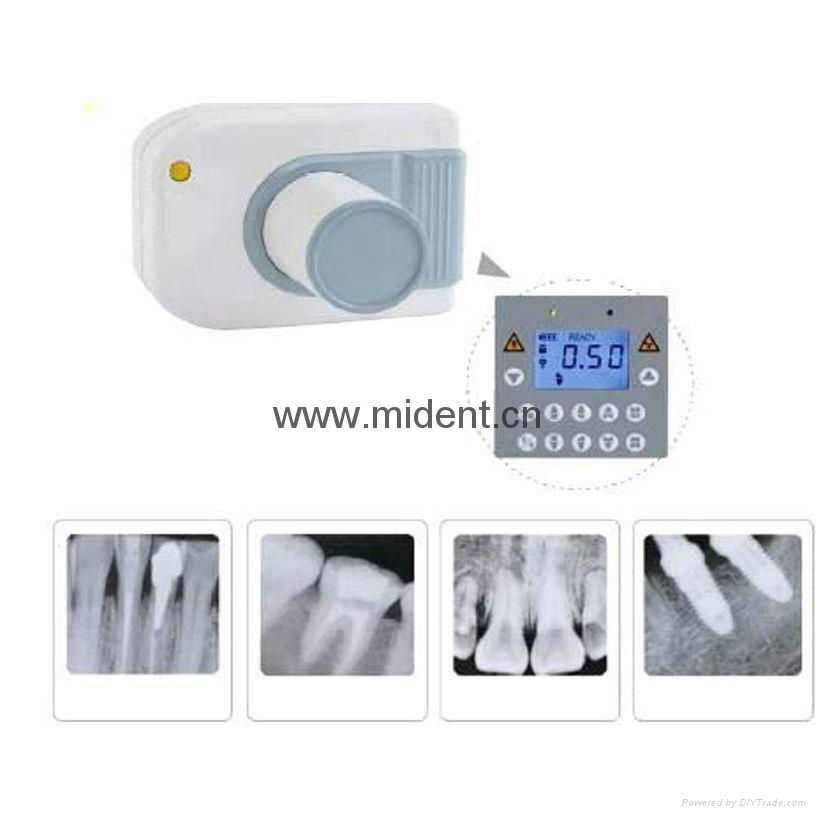 Digital X-Ray Machine Portable Dental X Ray Unit High Quality Imaging System