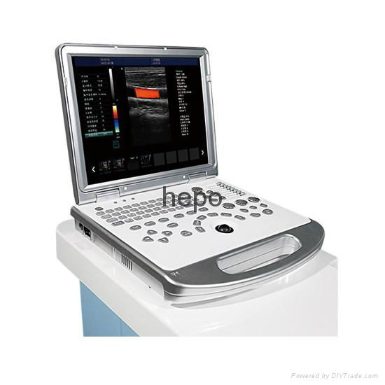 Portable 3D Color Doppler Ultrasound and Scanner System