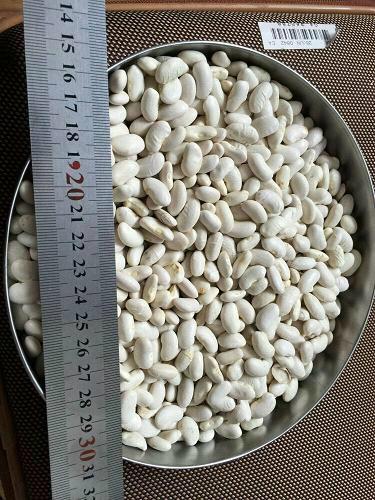 white kidney beans 3