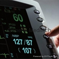 12 Inch Multiparameter Patient Monitor with CE FDA 2