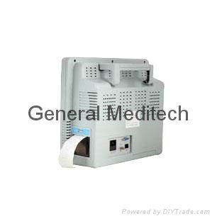 15.1 inch patient monitor 