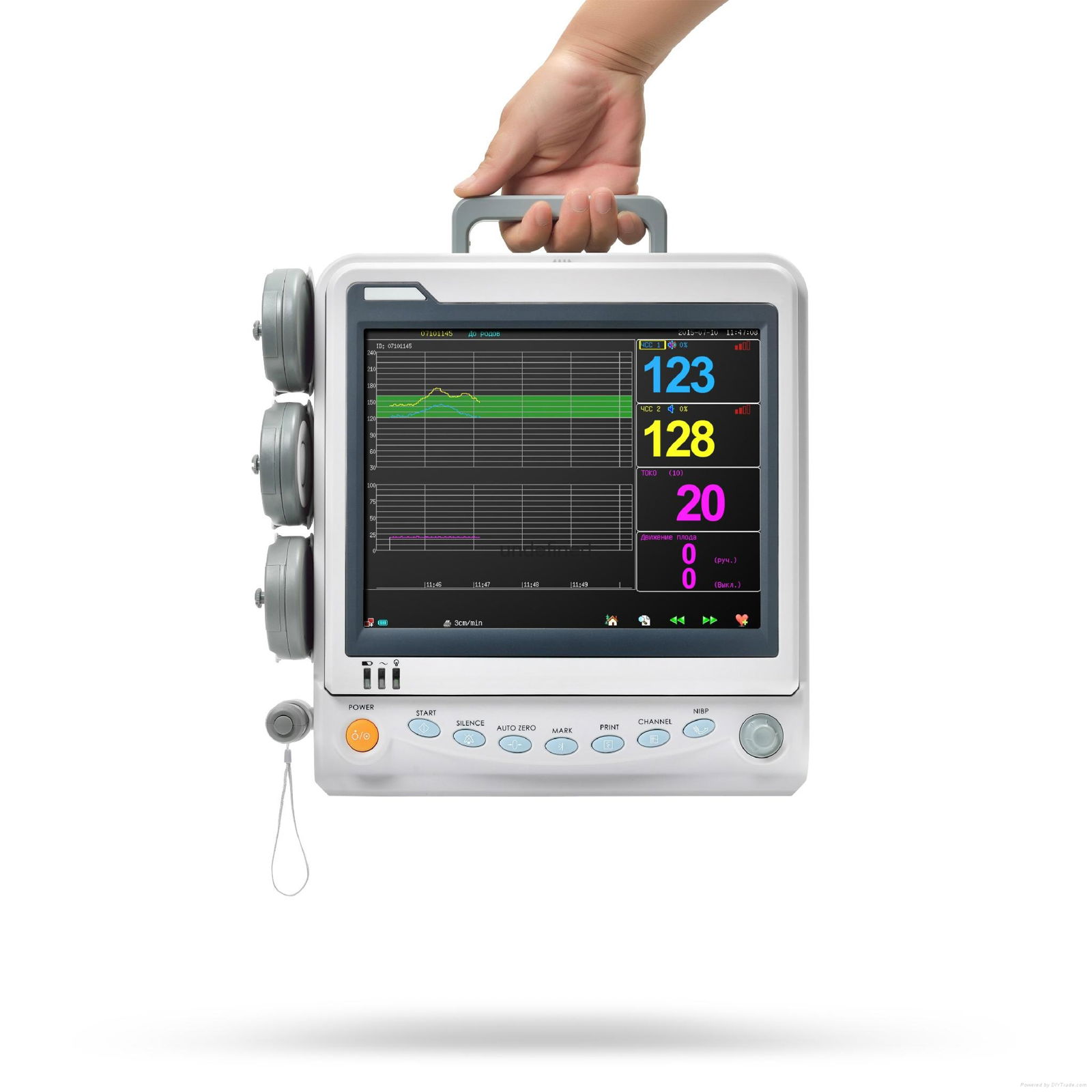 fetal monitor CTC machine 2