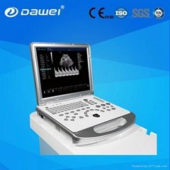 laptop color doppler ultrasound scanner DW-C60 PLUS
