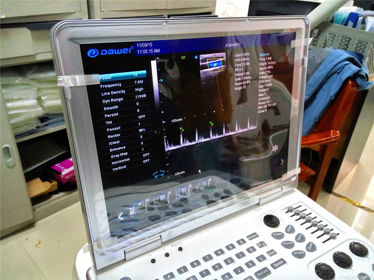 laptop color doppler ultrasound scanner DW-C60 PLUS 5