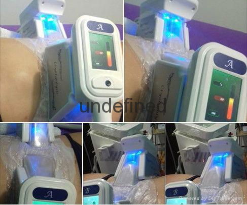 cryolipolysis slimming machine for weight loss Zelqit Coolshaping body slimming 5