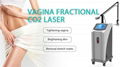 skin resurfacing co2 fractional laser acne removal skin tightening