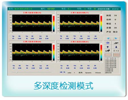 M普通版颅内经颅多普勒检测仪 4