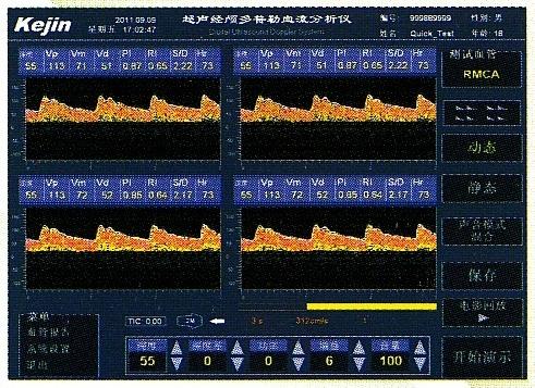 数字化超声经颅多普勒模块  可定制 厂家原装 5