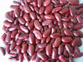 Dark red kidney beans 1