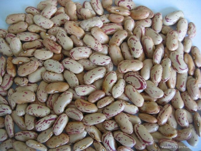 Light speckled kidney beans(long shape)
