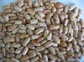 Light speckled kidney beans(long shape)