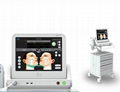 CE approved HIFU(high intensity focused ultrasound)