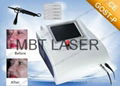 Medical 30MHz Spider Vein and laser skin rejuvenation machine with CE certificat