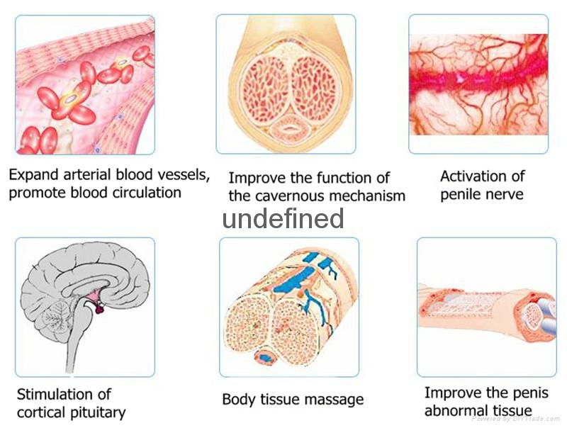 ED Erectile dysfunction rehabilitation male sexual function medical instrument 4