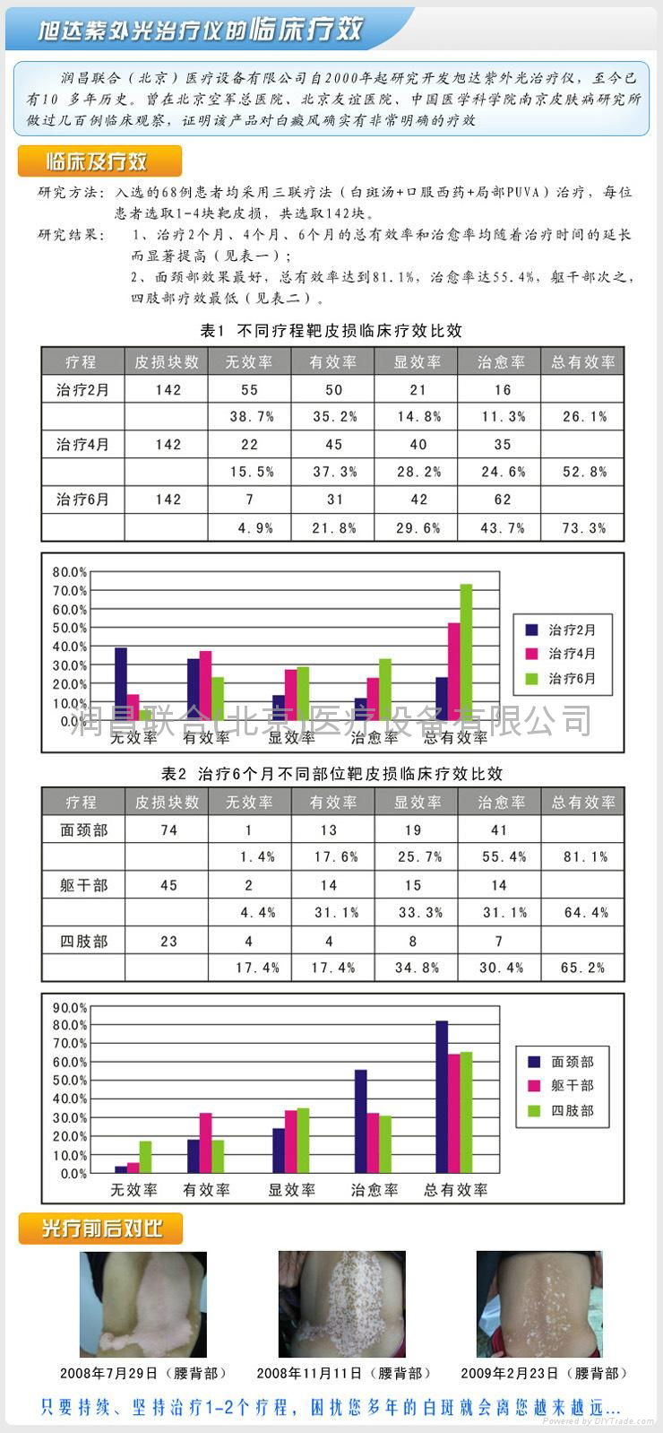 XD-I型旭達黑光燈牌UVA紫外光線白癜風治療儀器 5