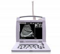 Portable Ultrasound Machine and Ultrasound Scanner and Ultrasound Device