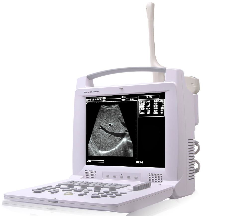 Portable Ultrasound Machine and Ultrasound Scanner and Ultrasound Device 3