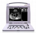 Full Digital Veterinary Portable Ultrasound Scanner 1