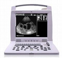 Full Digital Veterinary Portable Ultrasound Scanner