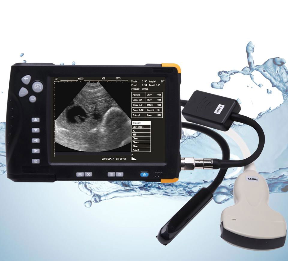 Waterproof Veterinary Ultrasound Scanner/Machine 2