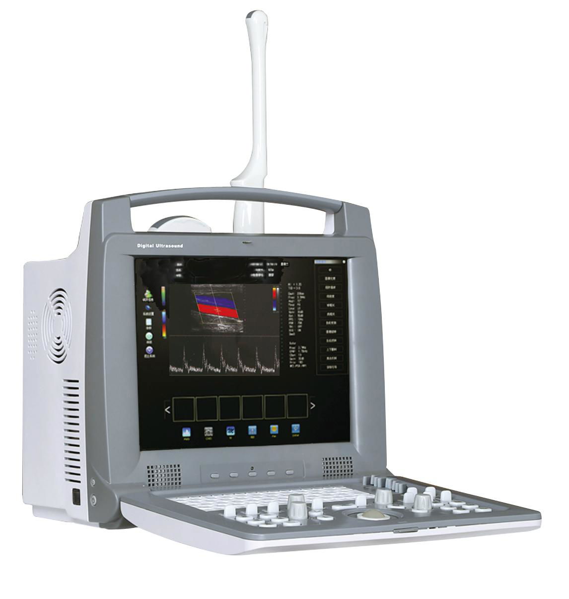 Portable 3D Color Doppler 3