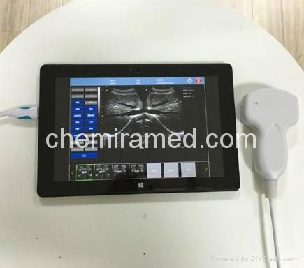 USB probe ultrasound scanner