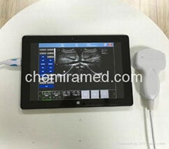 USB probe ultrasound scanner