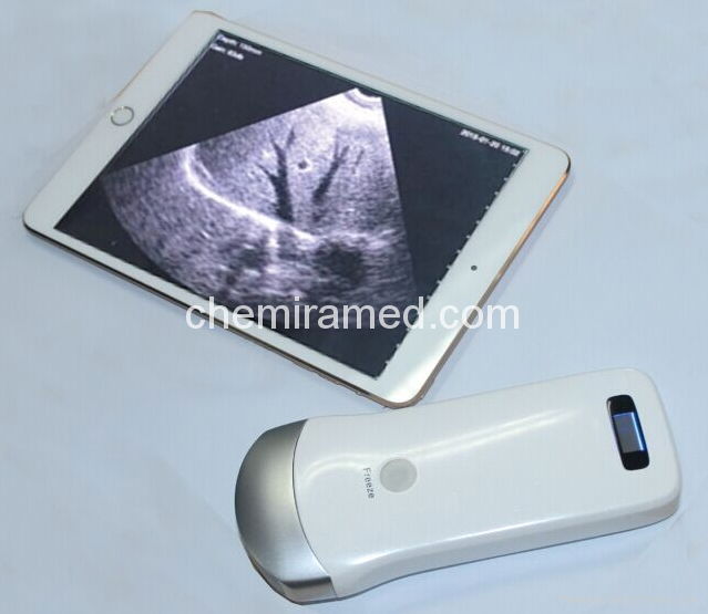 Wireless WIFI probe ultrasound