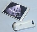 Wireless WIFI probe ultrasound 1