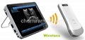 Wireless WIFI probe ultrasound 2