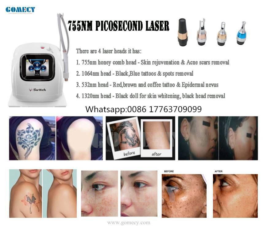 Fractional Pigment Removal Portable Laser Picosecond Active Q Switch
