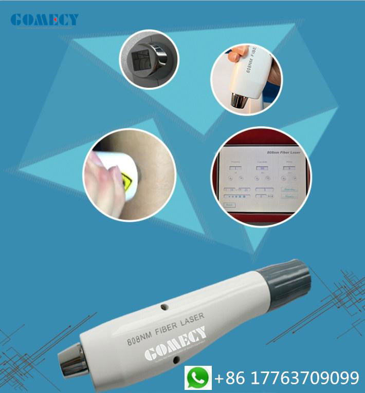 GOMECY 2019 New Technology 808 fiber optic coupled diode laser hair removal mach 2