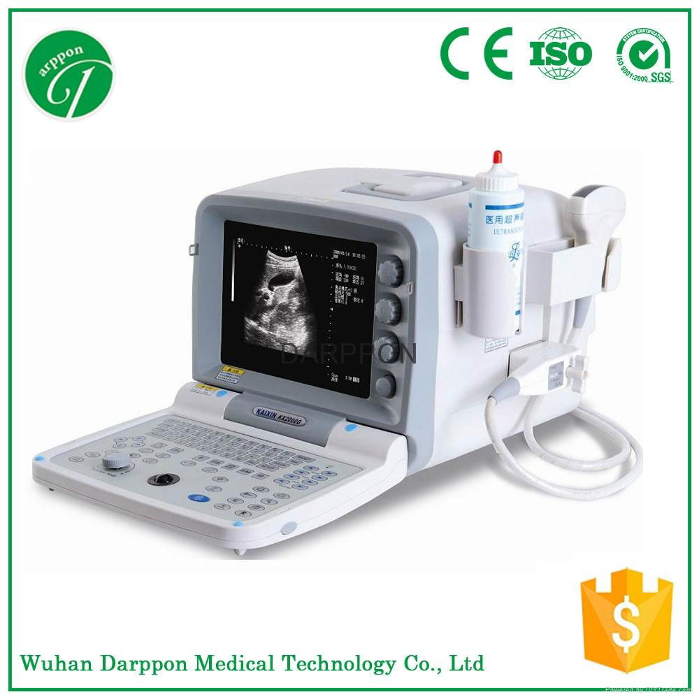 low price Portable Ultrasound machine from China factory
