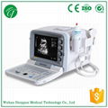 low price Portable Ultrasound machine